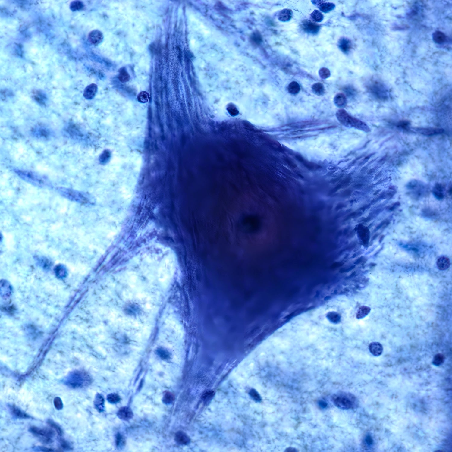 A microscopic view of a human brain neuron colorized