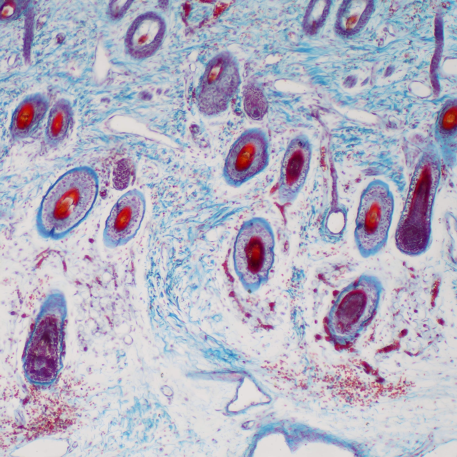 A microscopic cross-section of healthy human skin cells colorized