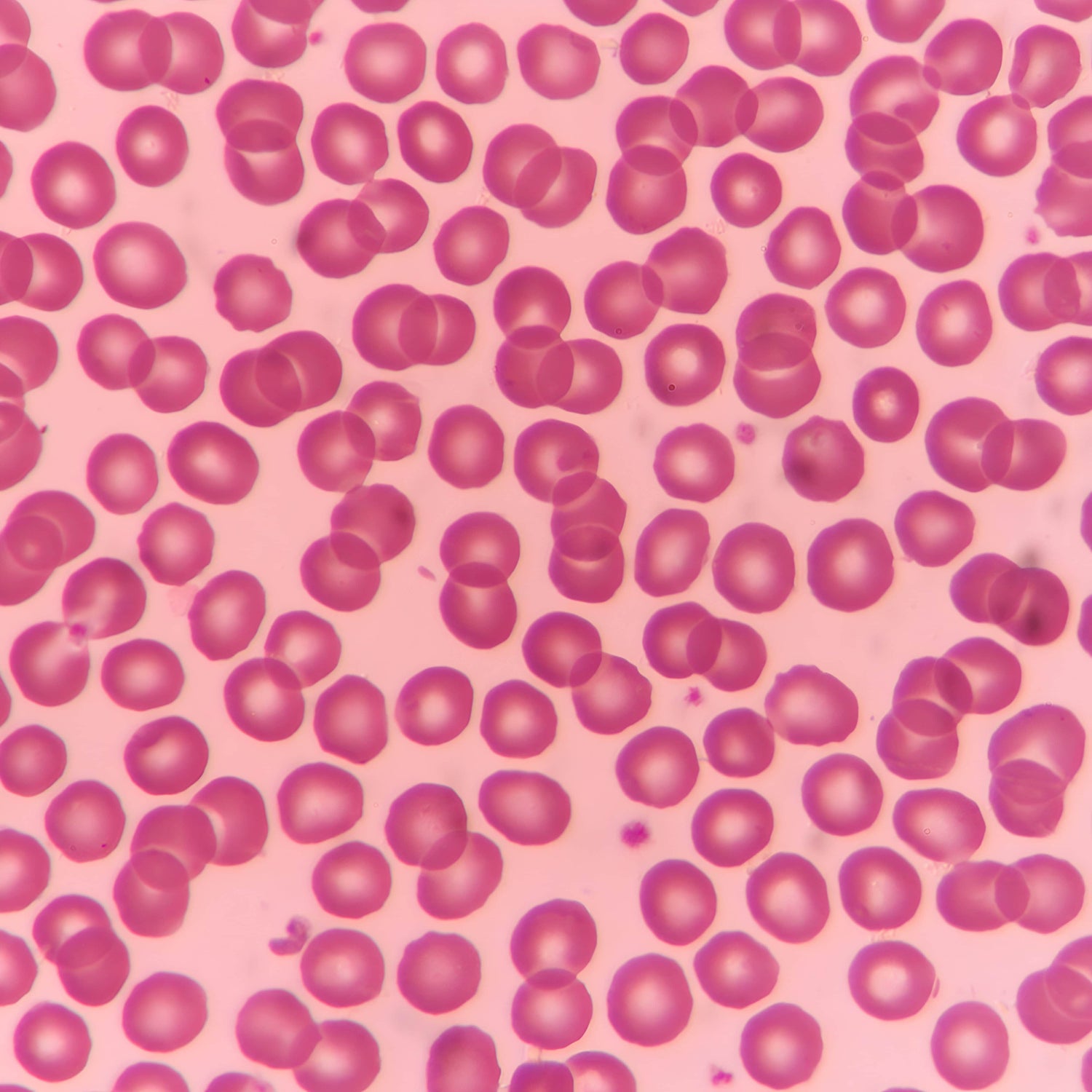 A microscopic image of healthy red blood cells colorized